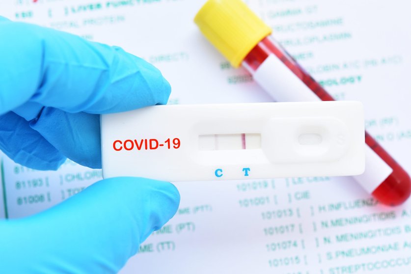 Test antígeno COVID-19